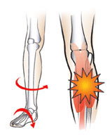 aching legs