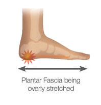 heel bone and plantar fascia