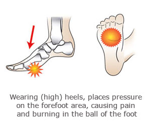 pressure in the ball of the foot